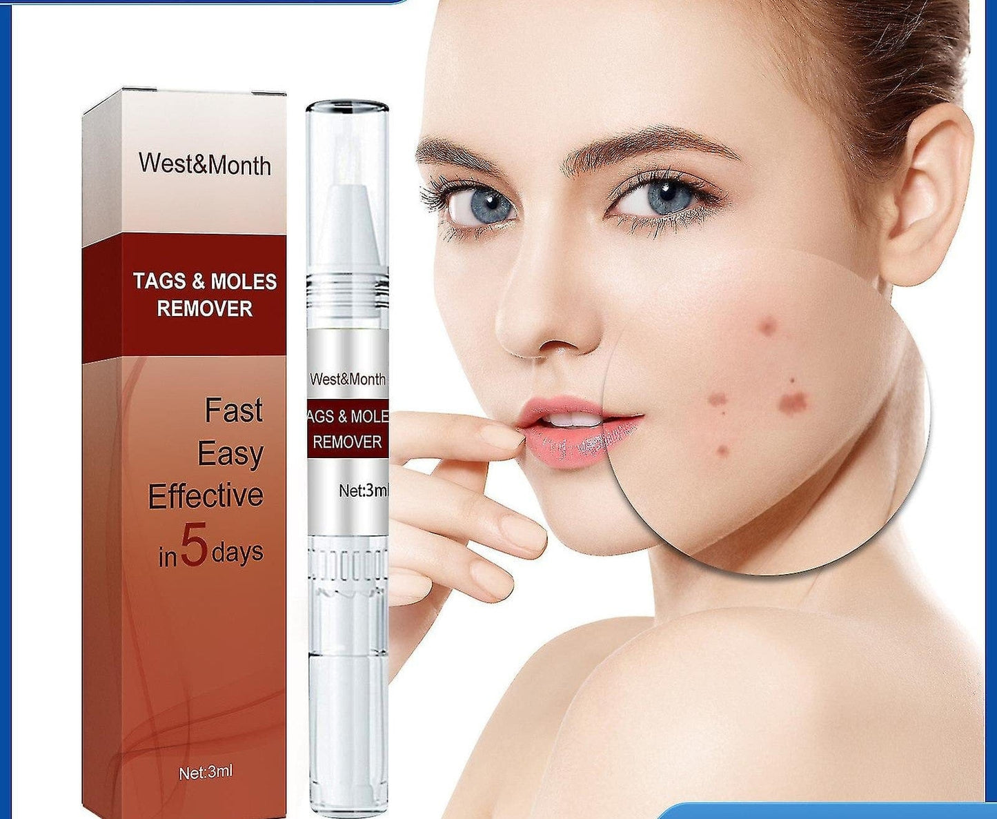 Professional Skin Tag & Mole Removal Device – Flawless Skin At Home